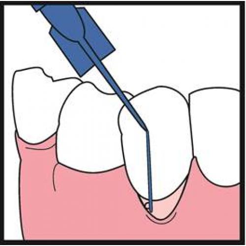 Cetacaine Topical Anesthetic Liquid Chairside Kit