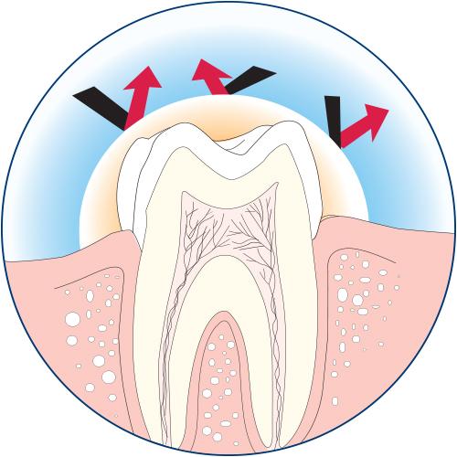 Varnal Cavity Varnish